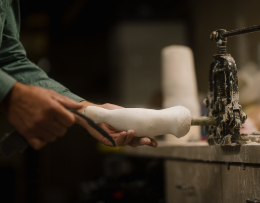 Chris, the owner of Anew Life Prosthetics and Orthotics, creates a mold